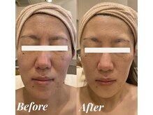 シェリール(Cherir)/ハーブトリートメント