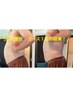 メンズ限定【ポッコリ腹 腰肉 内臓脂肪改善】ラジオ波×キャビ×解し&EMS 