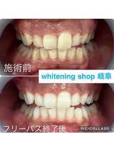ホワイトニングショップ 岐阜駅前/#岐阜ホワイトニング#岐阜エステ