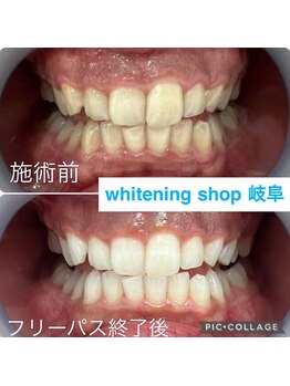 ホワイトニングショップ 岐阜駅前/#岐阜ホワイトニング#岐阜エステ