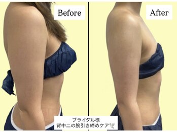 アオレニア(ao.lenia)/二の腕セル脂肪ケア♪ブライダル