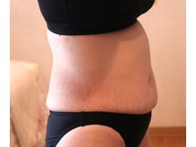 アーユルヴェーダ痩身サロン サムサラ(SAMSARA)の雰囲気（BEFORE⇒体の不調や気になる所、生活習慣などをカウンセリング♪）