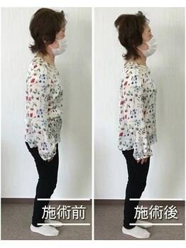 ファミリア整体院の写真/【猫背、反り腰、巻き肩お任せください◎】姿勢改善整体