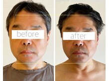 パル コルギサロン(Pal. Korugi salon)/メンズコルギビフォーアフター