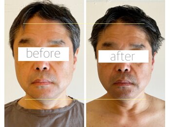 パル コルギサロン(Pal. Korugi salon)/メンズコルギビフォーアフター