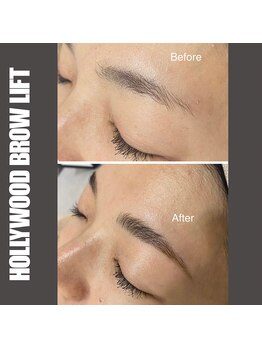 セラス(CERAS)/ハリウッドブロウリフト