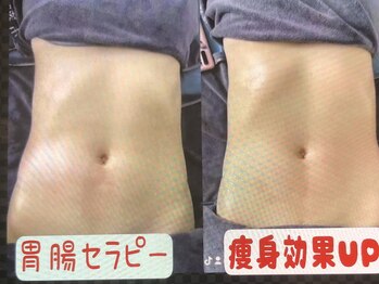 中国整体 らくらく堂/スピード痩身体験キャンペーン中