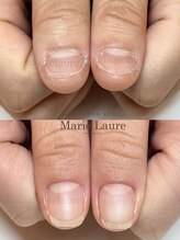 マリーロール 淀屋橋本店(Marie Laure)/自爪育成/深爪矯正/ネイルケア