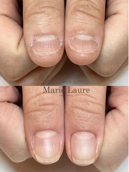 マリーロール 淀屋橋本店(Marie Laure)/自爪育成/深爪矯正/ネイルケア
