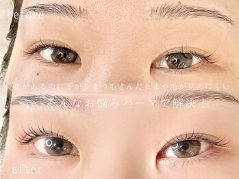 リルフィーユ(Rire Feuille)/下がりまつ毛さんのお悩み