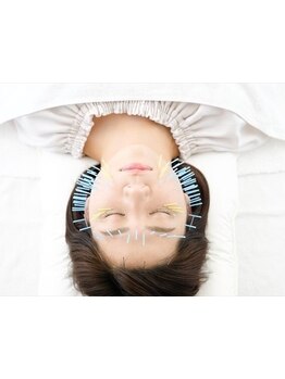 鍼灸施術を受けたい