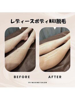 トリプルワン(111)/レディースボディWAX脱毛
