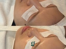 グレイスリリー 久屋 栄(grace lily)/