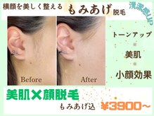 ヴィ シェーン(Vi Schoen)