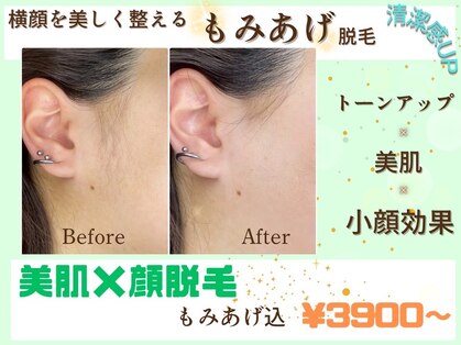 ヴィ シェーン(Vi Schoen)の写真