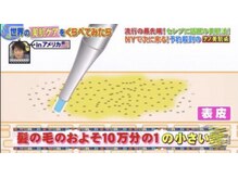 アンサナ 三軒茶屋(angsana)/エステ版ダーマ