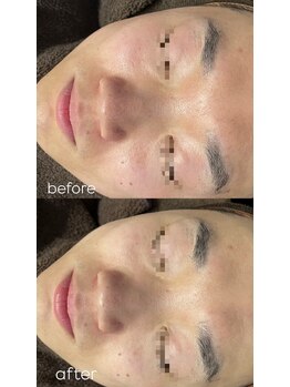 エクラ(ECLAT)/クールビタミン導入♪