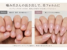 《コンプレックス爪卒業》噛み爪・深爪改善専門