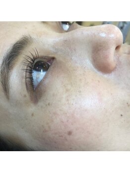 フリルアイビューティ 豊中店(Frill Eye Beauty)/