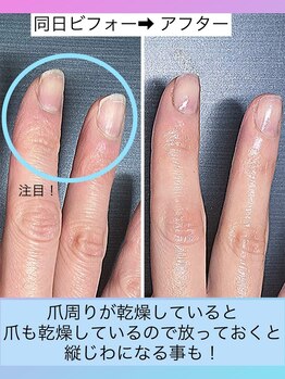 桃の木 吉祥寺店/自爪育成は日々の保湿ケアが大切