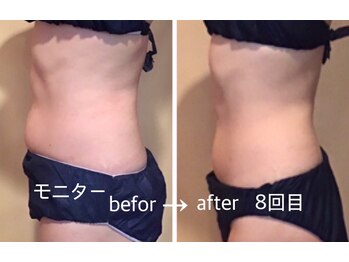 リリアーナ(LILIANA)/1箇所☆(痩身モニター)