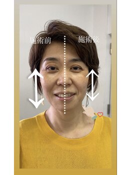 エスドット ビューティーサロン(S.beauty salon)/