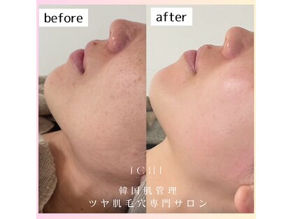 イチ(ichi)の写真