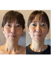 語 かたりべ/【エステ】ビフォー・アフター