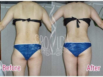 グラウディア 恵比寿/痩身/筋膜リリース/インディバ超