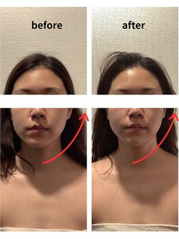 フォーリーフ(4 Leaf)/左右差にも変化が!