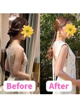 すみれ鍼灸整骨院/神戸　ブライダル美容整体