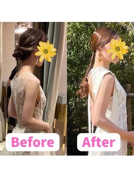 すみれ鍼灸整骨院/神戸 ブライダル美容整体