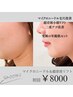 【年齢肌究極リフトアップ90分】マイクロニードル＆超音波　￥9000→￥8000