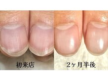 グラシナ 名古屋金山店/(深爪／長さだし/フィルイン)