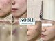 ハーブピーリング・毛穴洗浄　NOBLEハーブピーリング恵比寿店の写真
