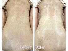 ルヴィカカリーナ(REVI Cacalena)/