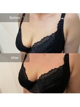 ハートランド(HEARTLAND)/プチ・クレオパトラ　1回