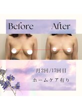 セイ(SEI)/高さが上がる