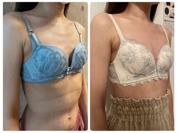 ハイファイブ(Hi-Five)/バストアップ/施術12回