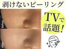 オーシャンブルー 日田店の雰囲気（テレビで放送された今韓国で話題の剥けないピーリング♪美白に◎）