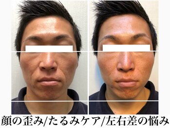 カイロプラクティック ネクサス/顔の歪み撃退☆