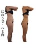 【二の腕・ハミ肉ケアに】筋膜痩身マシン×骨盤矯正★120分￥24200