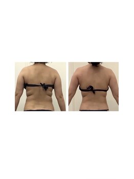 エスビーエス トウキョウ 錦糸町店(SBS TOKYO)/◆ビフォーアフター写真◆