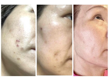 CBDサロン ローズ(ROSE)の写真