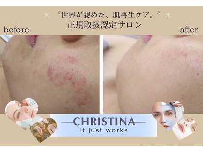 アンドエピ(&epi)の写真