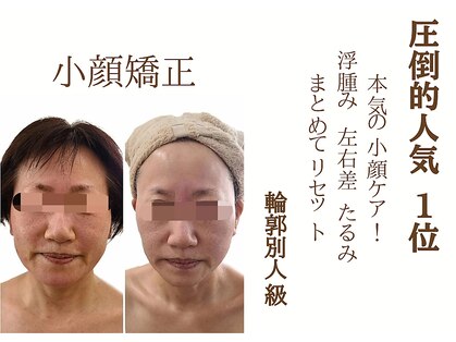 ウォーマル(warmaL)の写真