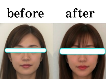 ピュアハリの写真