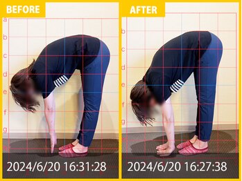 整体院 元 宇城松橋店/腰痛の悩みで来院されました