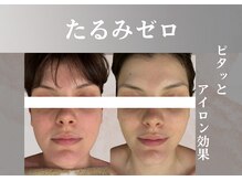 クリニカルボーテ 心斎橋院(CLINICAL BEAUTE)の雰囲気（本気のたるみケアが叶う！オリジナルの組み合わせで満足な結果に）