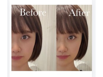 わたしの。三島店/簡単セルフエステ。月2回で効果